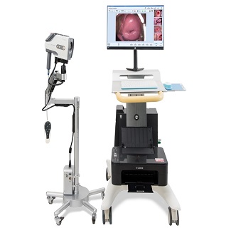 Digital Video Colposcope